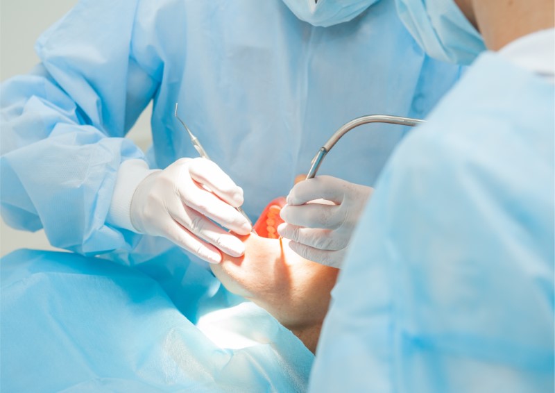 Chirurgia orale