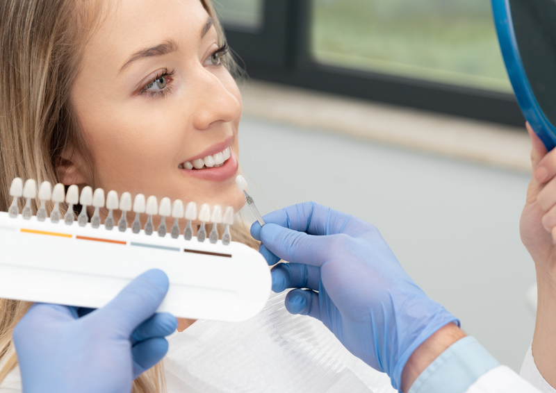 Faccette in ceramica